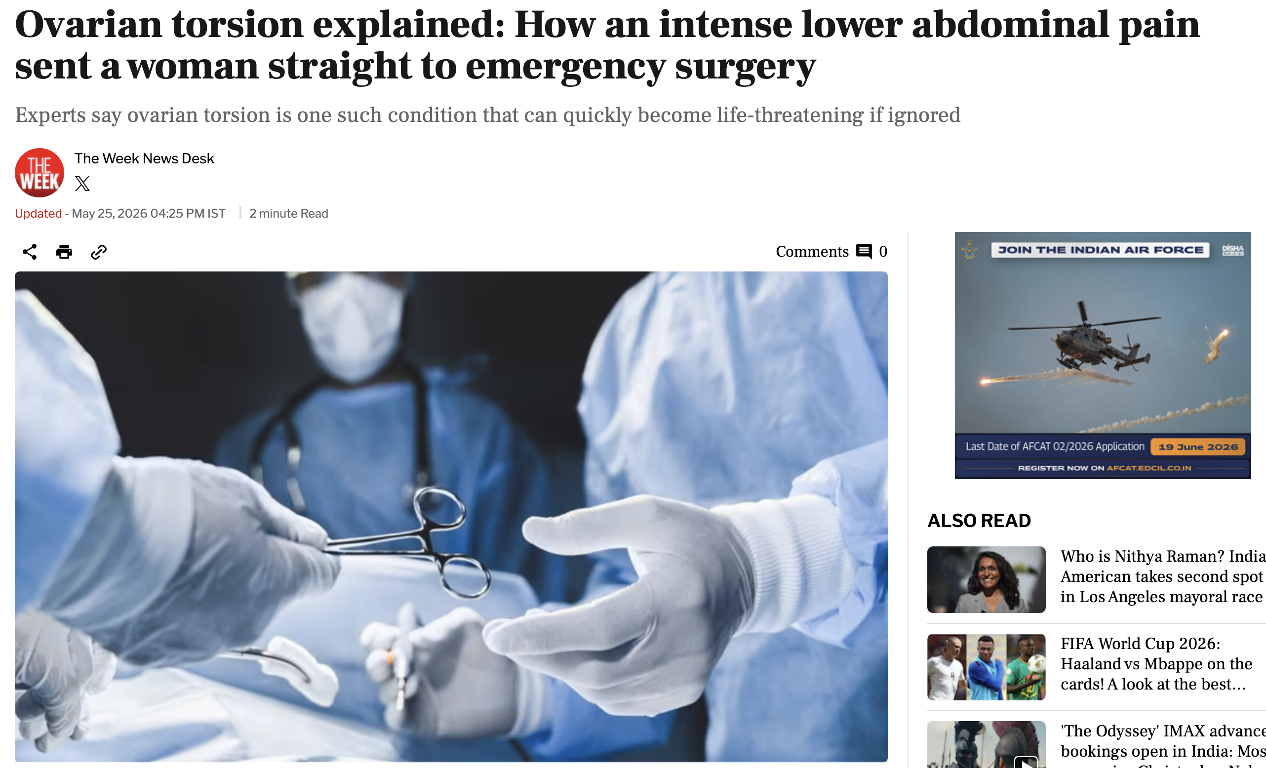 Ovarian torsion explained